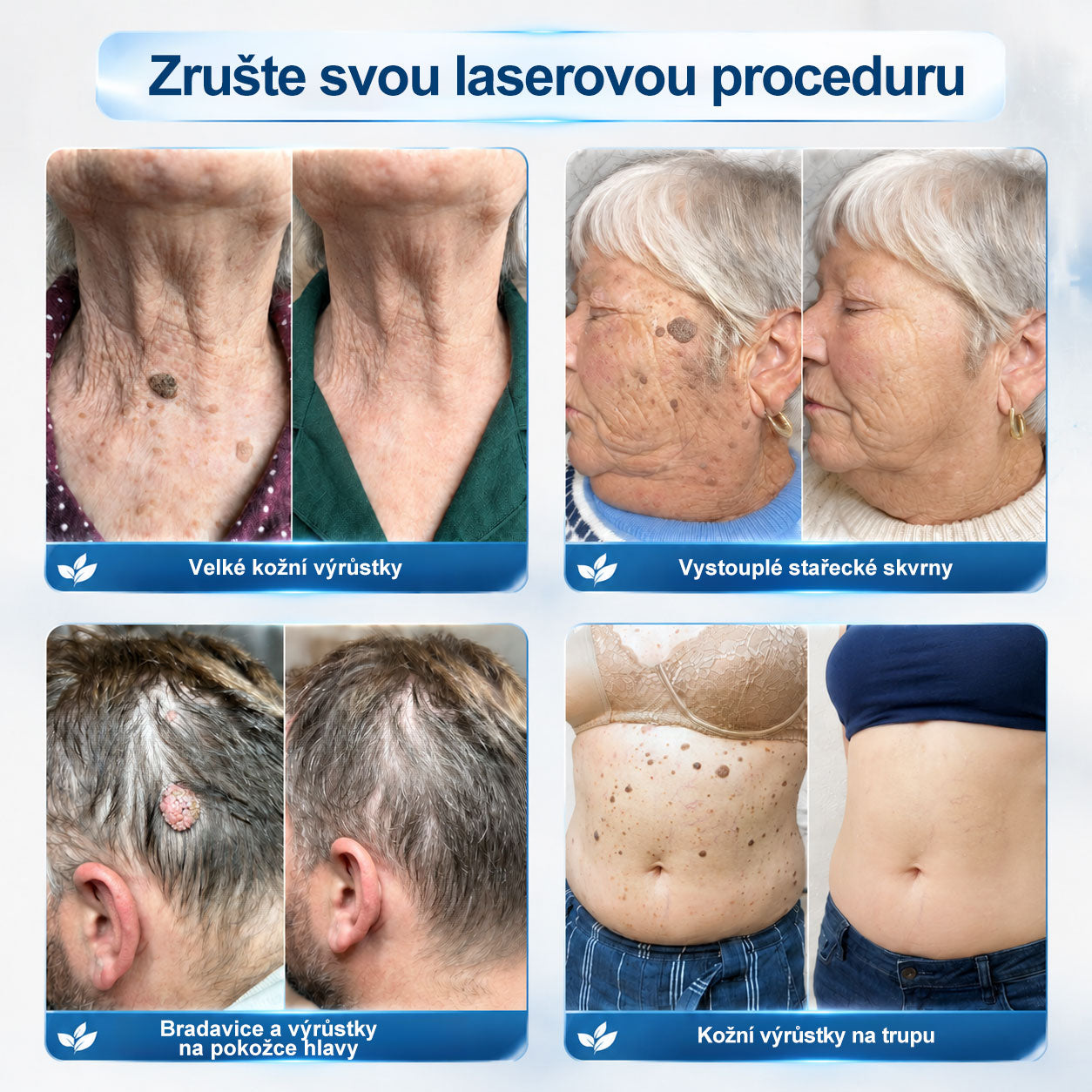 𝑶𝒇𝒊𝒄𝒊á𝒍𝒏í 𝒐𝒃𝒄𝒉𝒐𝒅 ✅ | 𝑃𝑖𝑐𝑑𝑜® 7𝒅𝒆𝒏𝒏í 𝒓𝒐𝒍𝒍-𝒐𝒏 𝒏𝒂 𝒐𝒅𝒔𝒕𝒓𝒂𝒏ě𝒏í 𝒌𝒐ž𝒏í𝒄𝒉 𝒔𝒌𝒗𝒓𝒏 𝒂 𝒌𝒐ž𝒏í𝒄𝒉 𝒗ý𝒓ů𝒔𝒕𝒌ů 👩‍⚕️(𝒃𝒆𝒛𝒃𝒐𝒍𝒆𝒔𝒕𝒏á 𝒂𝒑𝒍𝒊𝒌𝒂𝒄𝒆, 𝒑𝒐𝒉𝒐𝒅𝒍𝒏é 𝒑𝒐𝒖ž𝒊𝒕í) ❤️‍🔥