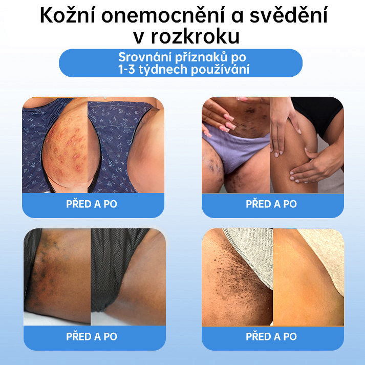 𝗹𝘂𝗸𝗺𝗹𝗰𝗮® 𝑪𝒐𝒐𝒍𝑬𝒓𝒂𝒔𝒆 𝒔𝒑𝒓𝒆𝒋 𝒑𝒓𝒐 𝒓𝒆𝒈𝒆𝒏𝒆𝒓𝒂𝒄𝒊 𝒑𝒐𝒌𝒐ž𝒌𝒚🌿 (𝐵𝑟𝑎𝑑𝑎𝑣𝑖𝑐𝑒, 𝑃𝑢𝑐ℎýř𝑒, 𝐸𝑘𝑧é𝑚, 𝐿𝑢𝑝𝑦, 𝐾𝑜ž𝑛í 𝑘𝑒𝑟𝑎𝑡ó𝑧𝑦, 𝐴𝑘𝑛é, 𝐾𝑜ž𝑛í 𝑣ý𝑟ů𝑠𝑡𝑘𝑦, 𝐽𝑖𝑧𝑣𝑦, 𝑀𝑎𝑡𝑒ř𝑠𝑘á 𝑧𝑛𝑎𝑚é𝑛𝑘𝑎)🔥