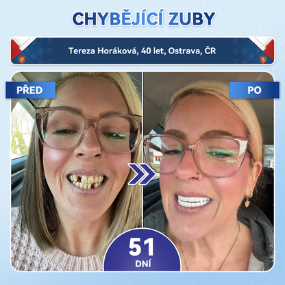 𝑮𝒍𝒊𝑚𝑚𝒆𝒓𝒍𝒚®🦷 𝑻𝒊𝒅𝒆𝒈𝒍𝒖𝒔𝒊𝒃 𝑴𝒊𝒄𝒓𝒐𝒏𝒆𝒆𝒅𝒍𝒆 𝑷𝒂𝒕𝒄𝒉 𝒏𝒂 𝒐𝒑𝒓𝒂𝒗𝒖 𝒛𝒖𝒃ů 𝒂 𝒅á𝒔𝒏í | 𝐏𝐨𝐤𝐫𝐨č𝐢𝐥é 𝐧á𝐩𝐥𝐚𝐬𝐭𝐢 𝐩𝐫𝐨 𝐚𝐤𝐭𝐢𝐯𝐚𝐜𝐢 𝐤𝐦𝐞𝐧𝐨𝐯ý𝐜𝐡 𝐛𝐮𝐧ě𝐤 𝐳𝐮𝐛ů 👩‍⚕️(𝑂𝑏𝑛𝑜𝑣𝑎 𝑧𝑢𝑏𝑛í 𝑠𝑘𝑙𝑜𝑣𝑖𝑛𝑦 𝑎 𝑑𝑒𝑛𝑡𝑖𝑛𝑢 • 𝑃𝑜𝑠í𝑙𝑒𝑛í 𝑑á𝑠𝑛í • 𝑂𝑑𝑠𝑡𝑟𝑎𝑛ě𝑛í 𝑧𝑢𝑏𝑛íℎ𝑜 𝑘𝑎𝑚𝑒𝑛𝑒 𝑎 𝑧á𝑝𝑎𝑐ℎ𝑢 • 𝑍𝑎𝑠𝑡𝑎𝑣𝑒𝑛í 𝑐𝑖𝑡𝑙𝑖𝑣𝑜𝑠𝑡𝑖 𝑧𝑢𝑏ů)🔥
