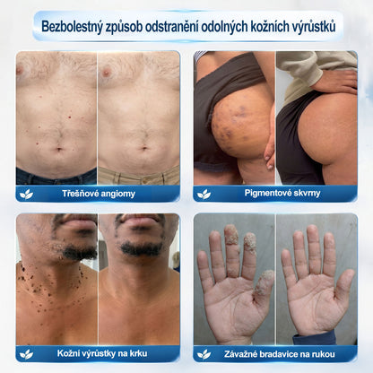 Oficiální značkový obchod |🖊️𝐏𝐢𝐜𝑑𝑜® 𝟩𝖽𝖾𝗻𝗻í 𝘰𝘥𝘴𝘵𝗋𝖺ň𝗈𝗏𝖺č 𝒔𝒌𝒗𝒓𝙣 𝙖 𝙥𝙞𝙜𝙢𝙚𝙣𝙩𝘰𝘷ý𝘤𝘩 𝘴𝘬𝖛𝖗𝖓 (Bezbolestný rollerball bez jizev)🪴