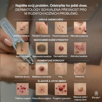 𝑶𝒇𝒊𝒄𝒊á𝒍𝒏í 𝒐𝒃𝒄𝒉𝒐𝒅 ✅ | 𝑃𝑖𝑐𝑑𝑜® 7𝒅𝒆𝒏𝒏í 𝒓𝒐𝒍𝒍-𝒐𝒏 𝒏𝒂 𝒐𝒅𝒔𝒕𝒓𝒂𝒏ě𝒏í 𝒌𝒐ž𝒏í𝒄𝒉 𝒔𝒌𝒗𝒓𝒏 𝒂 𝒌𝒐ž𝒏í𝒄𝒉 𝒗ý𝒓ů𝒔𝒕𝒌ů 👩‍⚕️(𝒃𝒆𝒛𝒃𝒐𝒍𝒆𝒔𝒕𝒏á 𝒂𝒑𝒍𝒊𝒌𝒂𝒄𝒆, 𝒑𝒐𝒉𝒐𝒅𝒍𝒏é 𝒑𝒐𝒖ž𝒊𝒕í) ❤️‍🔥