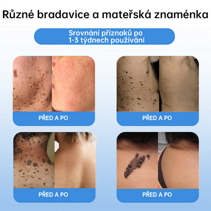 𝗹𝘂𝗸𝗺𝗹𝗰𝗮® 𝑪𝒐𝒐𝒍𝑬𝒓𝒂𝒔𝒆 𝒔𝒑𝒓𝒆𝒋 𝒑𝒓𝒐 𝒓𝒆𝒈𝒆𝒏𝒆𝒓𝒂𝒄𝒊 𝒑𝒐𝒌𝒐ž𝒌𝒚🌿 (𝐵𝑟𝑎𝑑𝑎𝑣𝑖𝑐𝑒, 𝑃𝑢𝑐ℎýř𝑒, 𝐸𝑘𝑧é𝑚, 𝐿𝑢𝑝𝑦, 𝐾𝑜ž𝑛í 𝑘𝑒𝑟𝑎𝑡ó𝑧𝑦, 𝐴𝑘𝑛é, 𝐾𝑜ž𝑛í 𝑣ý𝑟ů𝑠𝑡𝑘𝑦, 𝐽𝑖𝑧𝑣𝑦, 𝑀𝑎𝑡𝑒ř𝑠𝑘á 𝑧𝑛𝑎𝑚é𝑛𝑘𝑎)🔥