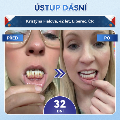 𝑮𝒍𝒊𝑚𝑚𝒆𝒓𝒍𝒚®🦷 𝑻𝒊𝒅𝒆𝒈𝒍𝒖𝒔𝒊𝒃 𝑴𝒊𝒄𝒓𝒐𝒏𝒆𝒆𝒅𝒍𝒆 𝑷𝒂𝒕𝒄𝒉 𝒏𝒂 𝒐𝒑𝒓𝒂𝒗𝒖 𝒛𝒖𝒃ů 𝒂 𝒅á𝒔𝒏í | 𝐏𝐨𝐤𝐫𝐨č𝐢𝐥é 𝐧á𝐩𝐥𝐚𝐬𝐭𝐢 𝐩𝐫𝐨 𝐚𝐤𝐭𝐢𝐯𝐚𝐜𝐢 𝐤𝐦𝐞𝐧𝐨𝐯ý𝐜𝐡 𝐛𝐮𝐧ě𝐤 𝐳𝐮𝐛ů 👩‍⚕️(𝑂𝑏𝑛𝑜𝑣𝑎 𝑧𝑢𝑏𝑛í 𝑠𝑘𝑙𝑜𝑣𝑖𝑛𝑦 𝑎 𝑑𝑒𝑛𝑡𝑖𝑛𝑢 • 𝑃𝑜𝑠í𝑙𝑒𝑛í 𝑑á𝑠𝑛í • 𝑂𝑑𝑠𝑡𝑟𝑎𝑛ě𝑛í 𝑧𝑢𝑏𝑛íℎ𝑜 𝑘𝑎𝑚𝑒𝑛𝑒 𝑎 𝑧á𝑝𝑎𝑐ℎ𝑢 • 𝑍𝑎𝑠𝑡𝑎𝑣𝑒𝑛í 𝑐𝑖𝑡𝑙𝑖𝑣𝑜𝑠𝑡𝑖 𝑧𝑢𝑏ů)🔥